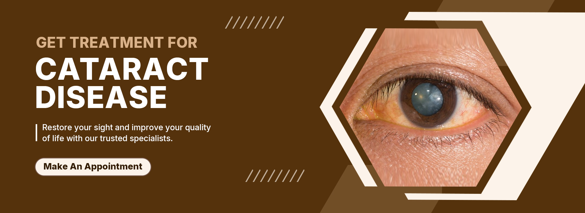 IBBANI-NEW-BANNER-2-(cataract)